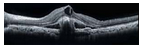 blob.png